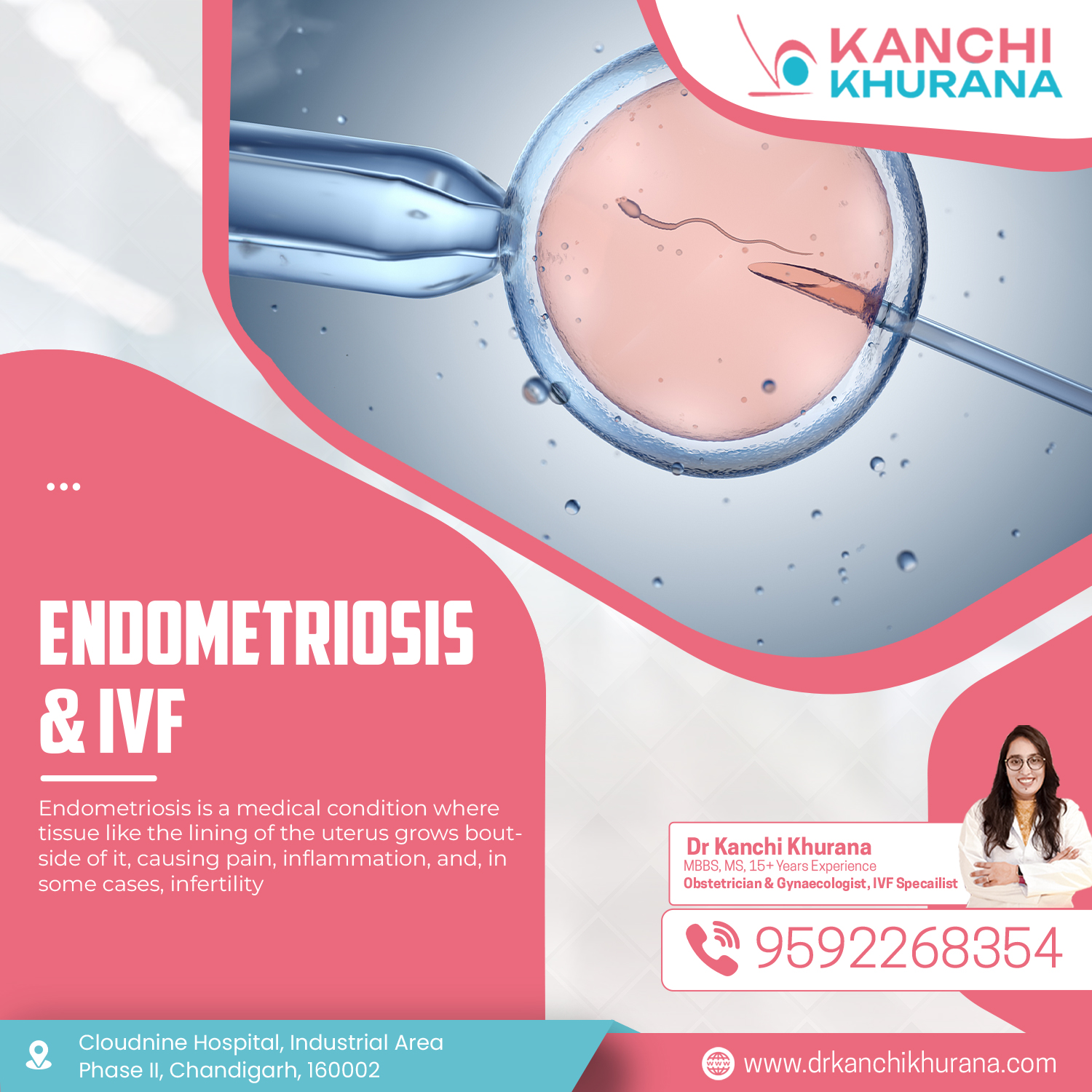 "Endometriosis treatment in Chandigarh by Dr. Kanchi Khurana